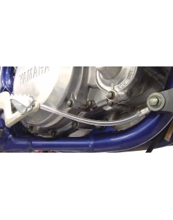 Pedal Anchor Kit: Universal fo
