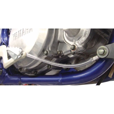 Pedal Anchor Kit: Universal fo